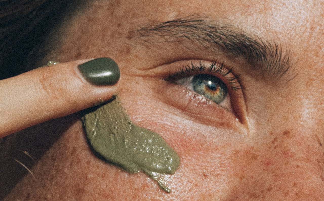 Freckles significa 'peca' en inglés, y de allí viene el nombre.